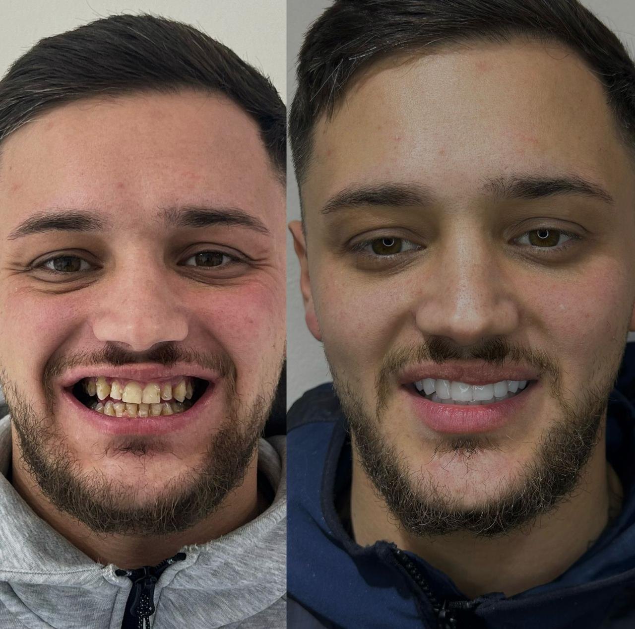 Prima e dopo caso 5
