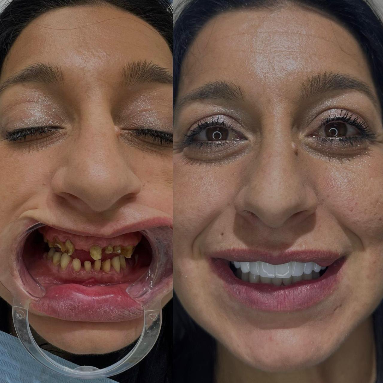 Prima e dopo caso 6